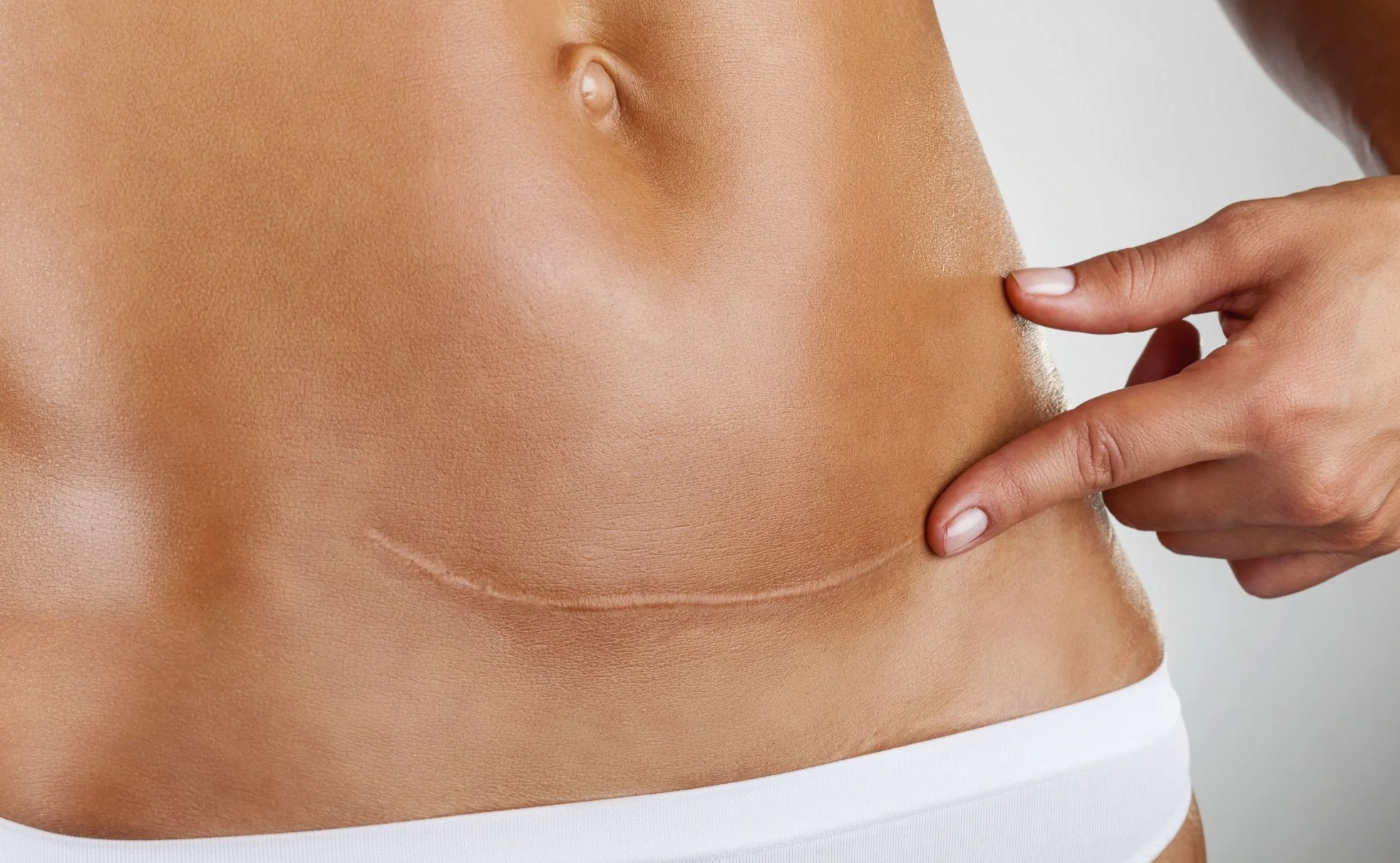 The McLoughlin Scar Tissue Release Technique